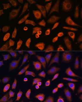 WASL antibody