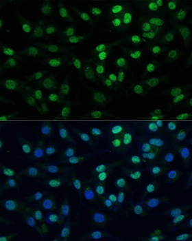 TIF1Beta antibody