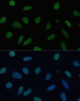 TIF1Beta antibody