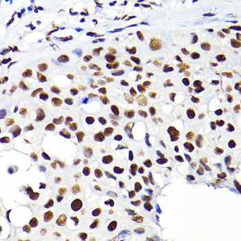 TIF1Beta antibody