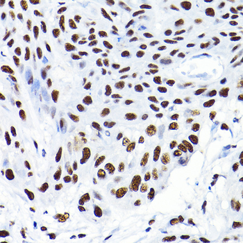 TIF1Beta antibody