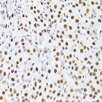 TIF1Beta antibody