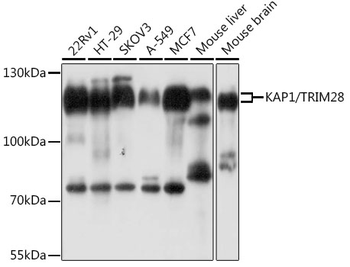 TIF1Beta antibody