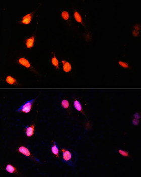 SETD2 antibody