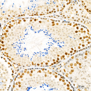 SETD2 antibody