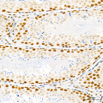 SETD2 antibody