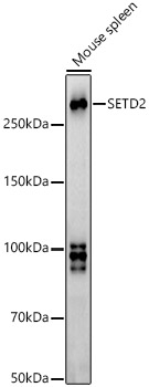 SETD2 antibody