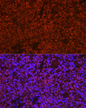 PYCARD antibody