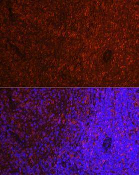 PYCARD antibody