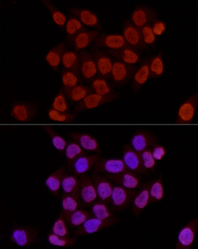 DiMethyl-Histone H3-K27 antibody