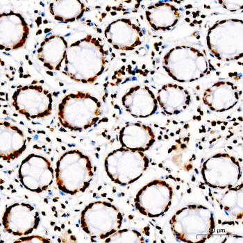 DiMethyl-Histone H3-K27 antibody