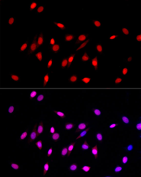 MonoMethyl-Histone H3-K27 antibody