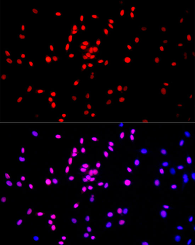 MonoMethyl-Histone H3-K27 antibody