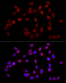 TriMethyl-Histone H3-K27 antibody