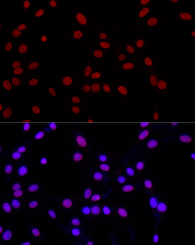 MonoMethyl-Histone H3-K4 antibody