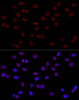 DiMethyl-Histone H3-K4 antibody