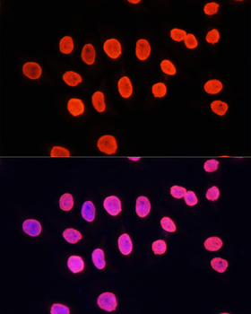 MonoMethyl-Histone H3-K9 antibody