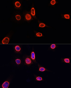 MonoMethyl-Histone H3-K9 antibody