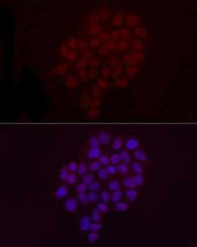 DiMethyl-Histone H3-K9 antibody