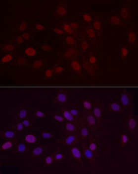 DiMethyl-Histone H3-K9 antibody