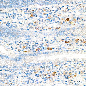 ACP5 antibody