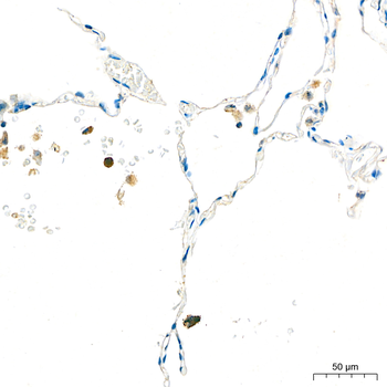 ACP5 antibody