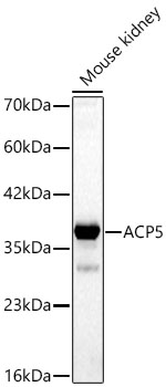 ACP5 antibody