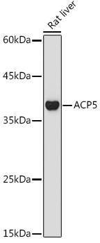 ACP5 antibody