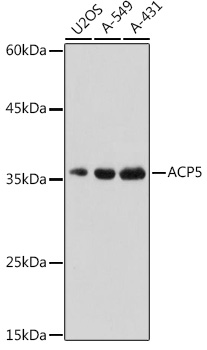 ACP5 antibody