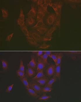 Caspase 3 antibody