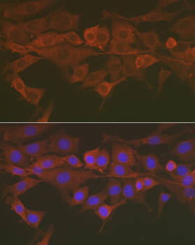 Caspase 3 antibody