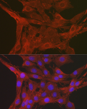 Caspase 3 antibody