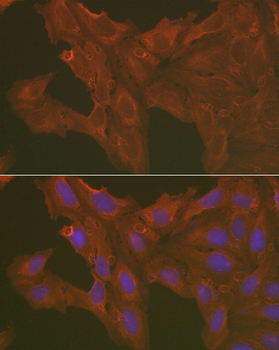 Caspase 3 antibody