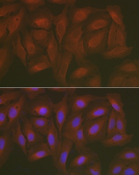 Caspase 3 antibody