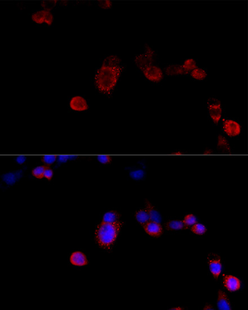 FLNB antibody