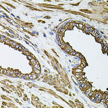 FLNB antibody