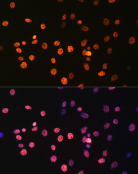 MonoMethyl-Histone H3-R17 antibody