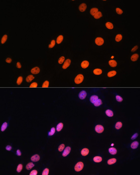 MonoMethyl-Histone H3-R17 antibody