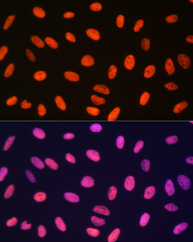 MonoMethyl-Histone H3-R17 antibody