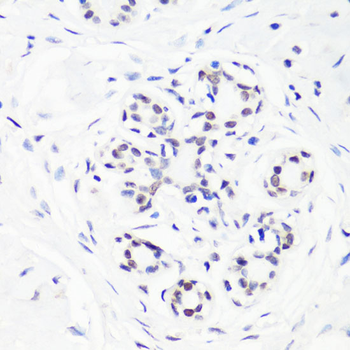 MonoMethyl-Histone H3-R17 antibody