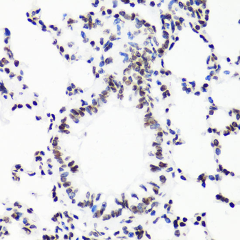 MonoMethyl-Histone H3-R17 antibody