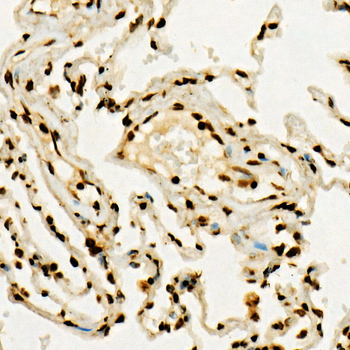 TriMethyl-Histone H3-K36 antibody