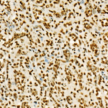 TriMethyl-Histone H3-K36 antibody