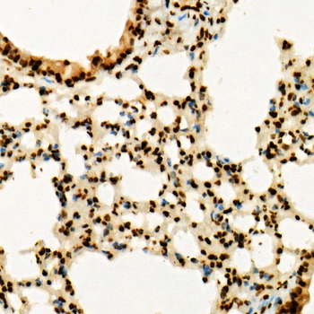 TriMethyl-Histone H3-K36 antibody