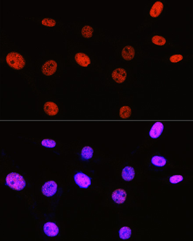 Symmetric DiMethyl-Histone H3-R2 antibody