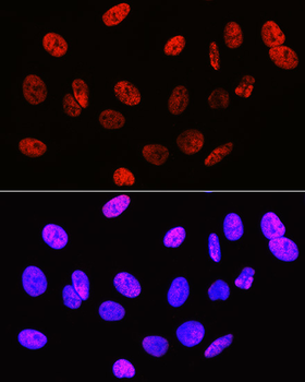 Symmetric DiMethyl-Histone H3-R2 antibody