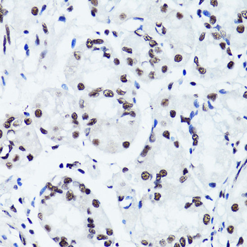 Symmetric DiMethyl-Histone H3-R2 antibody