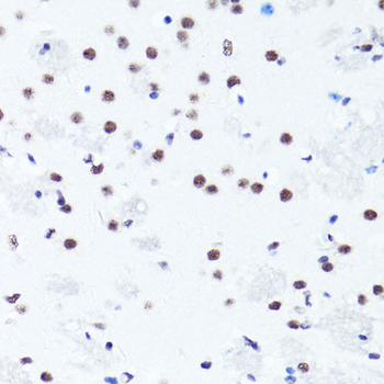 Symmetric DiMethyl-Histone H3-R2 antibody