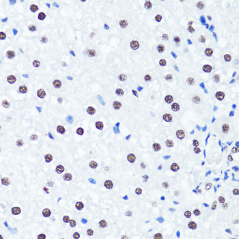 Symmetric DiMethyl-Histone H3-R2 antibody