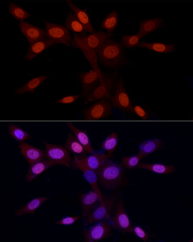 H3R2me2a antibody